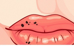 8 dấu hiệu trên môi cảnh báo sức khỏe có vấn đề