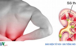 Những thực phẩm dễ gây sỏi thận nếu ăn quá nhiều