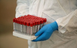 Xe tải chở lượng lớn mẫu bệnh phẩm COVID-19 bị cướp tại Nam Phi