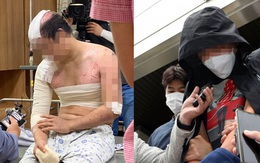 Hàn Quốc: Người đàn ông bị em trai dụ đến ở chung nhà chỉ trong 2 tháng, thân tàn ma dại vì bị hành hạ, đổ nước sôi lên người