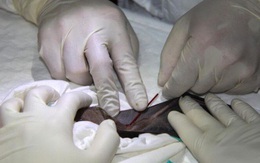 Phát hiện bất ngờ về virus SARS-CoV-2 gây bệnh Covid-19