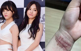NÓNG: Nữ idol Hàn công khai chuyện bị đàn chị cùng nhóm bắt nạt suốt 10 năm, hoảng sợ tới mức nhiều lần cắt cổ tay tự tử