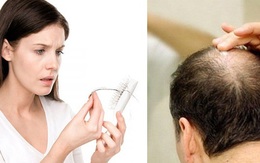 3 "thủ phạm" rụng tóc: người bị phải nhớ nguyên nhân còn điều trị