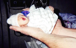 "Cô bé tí hon" sinh ra nằm lọt thỏm trong lòng bàn tay, bị chẩn đoán chỉ sống vài ngày nhưng 12 năm sau lại khiến thế giới kinh ngạc