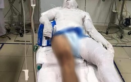 Vụ đổ xăng “thiêu sống” nam thanh niên giữa đường: Tạm giữ 1 nghi can