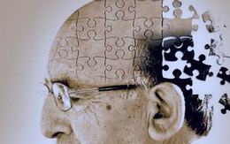 7 siêu thực phẩm giúp ngăn ngừa bệnh Alzheimer