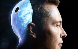 Neuralink và tham vọng "cộng sinh với trí tuệ nhân tạo" của Elon Musk