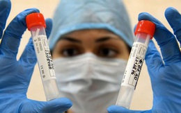 Nga sẽ bắt đầu sản xuất vaccine ngừa Covid-19 vào tháng 11