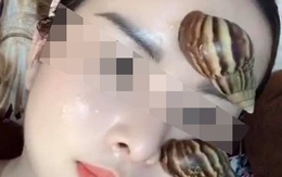 Nghe chất nhầy của ốc sên có khả năng làm đẹp da, cô gái lập tức ra vườn bắt cả bầy thả lên mặt làm thử nghiệm khiến dân mạng tranh cãi