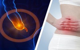 Bệnh lý viêm ruột thừa, sợ nhất hai từ “quá muộn”: Bác sĩ BV Việt Đức lưu ý những phản xạ cần có khi đau bụng để bảo toàn tính mạng