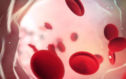 Nhóm máu duy nhất có thể tự động chống lại căn bệnh giết nửa triệu người mỗi năm, và cuối cùng khoa học cũng hiểu lý do tại sao
