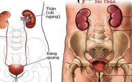 Phòng ngừa bệnh thận như thế nào?