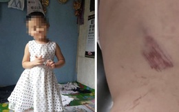 Bé gái 5 tuổi bị gã hàng xóm đưa đi trong đêm, nghi bị xâm hại với nhiều thương tích nghiêm trọng và hiện vẫn đang hôn mê trong bệnh viện