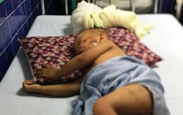 Chó becgie 38kg tuột xích tấn công bé trai 2 tuổi ở Quảng Bình nhập viện