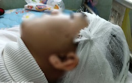 Sở GD-ĐT Thanh Hóa yêu cầu làm rõ trách nhiệm trong vụ nam sinh bị đánh vỡ sọ não