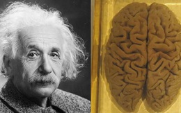 Cái chết của Albert Einstein và hành trình kỳ lạ của bộ não thiên tài