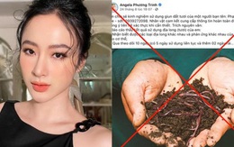 Đăng tin thất thiệt giun đất có thể chữa Covid-19, Angela Phương Trinh bị phạt 7,5 triệu đồng