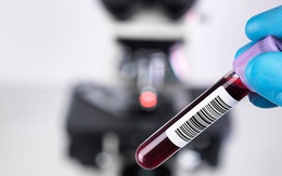 Sau tiêm 2 mũi vaccine COVID-19, có cần làm xét nghiệm kháng thể?