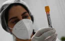 Số ca tử vong cao chưa từng thấy, Nga chế thuốc trị Covid-19