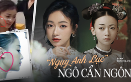 Ngô Cẩn Ngôn: "Ngụy Anh Lạc" chảnh choẹ dính 1001 phốt thẩm mỹ, ké fame Angela Baby giờ ra sao khi Diên Hi Công Lược hết hot?