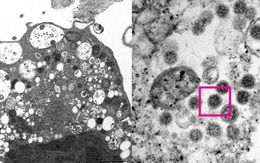COVID-19 sẽ tiếp diễn trong năm 2022 như thế nào?