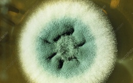 Loại nấm ‘rình rập’ bệnh nhân COVID-19, có thể đã giết chết hàng ngàn người