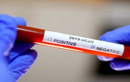 Kết quả xét nghiệm 9 trường hợp F1 của bệnh nhân COVID-19 nhập cảnh trái phép