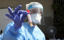 Israel công bố 'đột phá' trong điều trị COVID-19