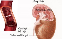 Dấu hiệu nhận biết chức năng thận suy giảm