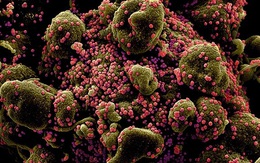 COVID-19 có thể phát triển thành bệnh xuất hiện theo mùa