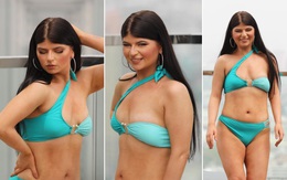 Hoa hậu diện bikini gây tranh cãi và câu chuyện khiến nhiều người khâm phục