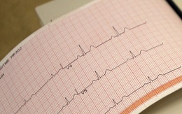 25% bệnh nhân mắc COVID-19 thể nặng bị bệnh tim mạch