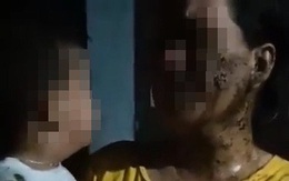 ĐBQH Phạm Thị Minh Hiền: Đổ chất bẩn lên trẻ 2 tuổi là xâm hại trẻ em nghiêm trọng