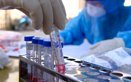 Đề nghị không công bố danh tính, chi tiết lịch trình bệnh nhân Covid-19