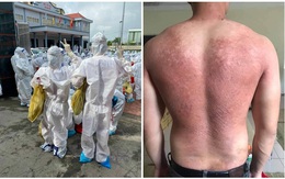 Cởi bỏ lớp áo bảo hộ, tấm lưng phồng rộp của cán bộ y tế ở Bắc Giang khiến tất cả xót xa