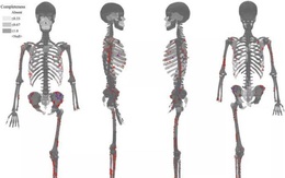 Giải mã bí ẩn bộ xương người tiền sử cụt chân: Cái chết rùng rợn, đau đớn, kinh hoàng