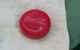 Mở chai Coca bằng miệng, chàng trai nhập viện vì nắp chai bắn thẳng vào khí quản