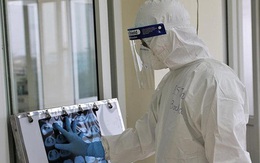 82 ca mắc COVID-19 tiên lượng rất nặng, 9 người đang phải hỗ trợ tim phổi nhân tạo