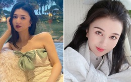 Hot girl Trung Quốc tử vong sau khi trải qua ba ca phẫu thuật thẩm mỹ một ngày