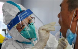 COVID-19 tới 6h sáng 4/7: Thế giới vượt 184 triệu ca mắc; Ca tử vong ở Nga cao chưa từng thấy