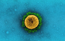 Biến thể COVID-19 mới Lambda: Nó nguy hiểm đến đâu, có kháng được vắc-xin hay không?