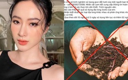 Angela Phương Trinh bị Sở TT&TT TP.HCM mời làm việc vì đăng tin 'giun đất chữa được COVID-19'