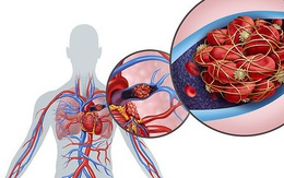 Bệnh COVID-19 tấn công những bộ phận nào của cơ thể?