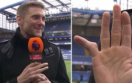Cựu thủ môn Chelsea khoe ngón tay biến dạng đáng sợ, đồng nghiệp đứng cạnh buông lời nói đùa khiến tất cả im bặt