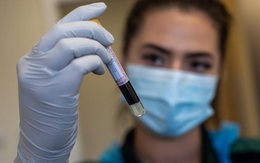 Forbes: Nghiên cứu mới chỉ ra nhiều người từng mắc Covid-19 không phát triển kháng thể