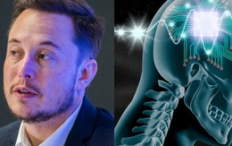 Công ty của Elon Musk chuẩn bị cấy ghép chip vào não người để "chế tạo" siêu nhân