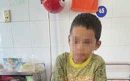 Quảng Bình: Một cháu bé bị cha dùng xăng và rơm đốt