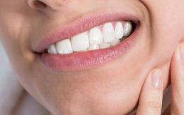 Nguyên nhân gây ra sâu răng mà bạn nên tránh