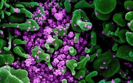 Phát hiện biến chủng COVID-19 mới BW.1 mang 54 đột biến, lan nhanh ở Mexico