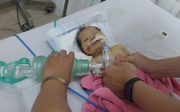 Sức khỏe cháu bé bị bỏ rơi giữa rừng ở Quảng Nam chuyển biến xấu